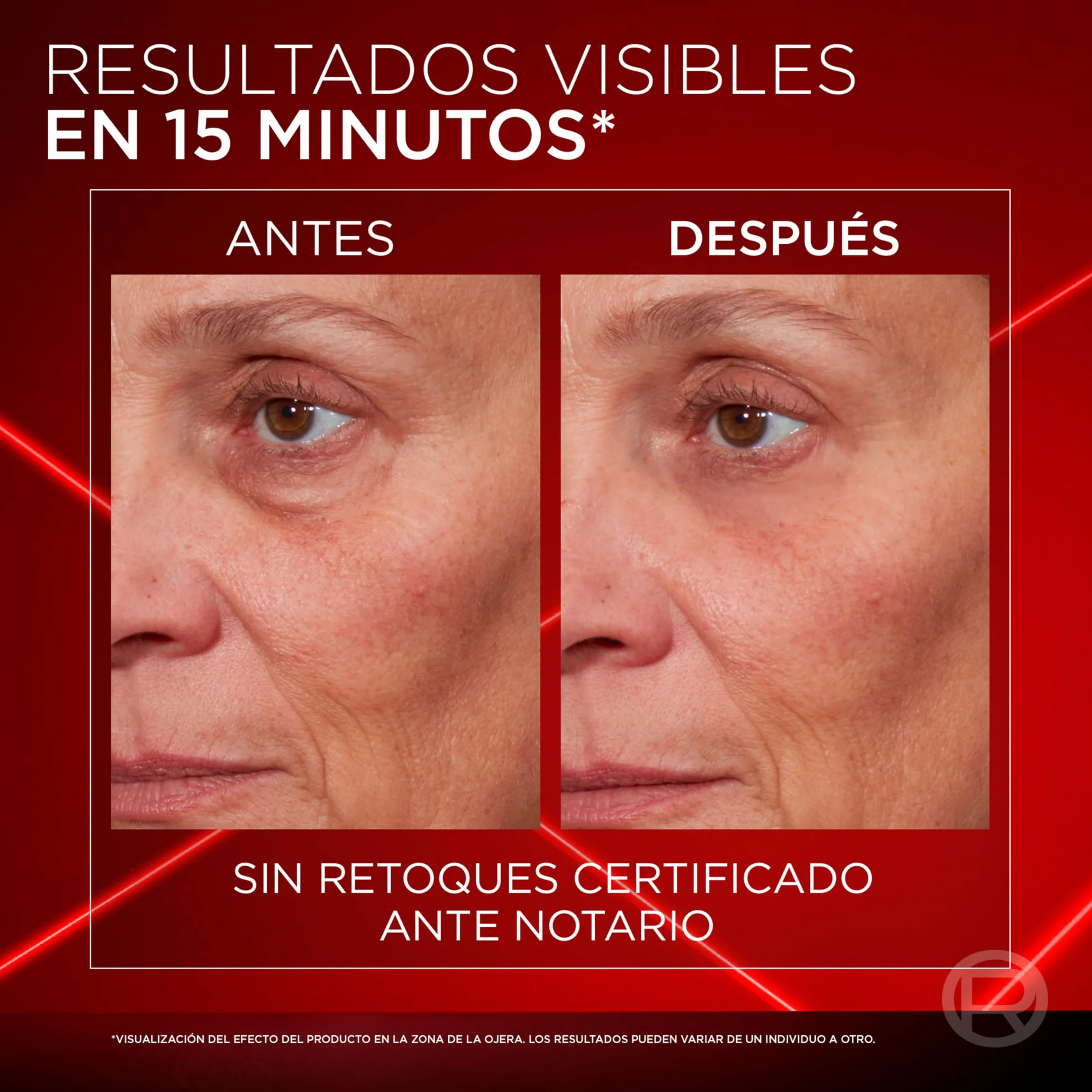L'Oréal Paris Revitalift Laser Instant Eraser Anti-Shage krem pod oczy 15 ml