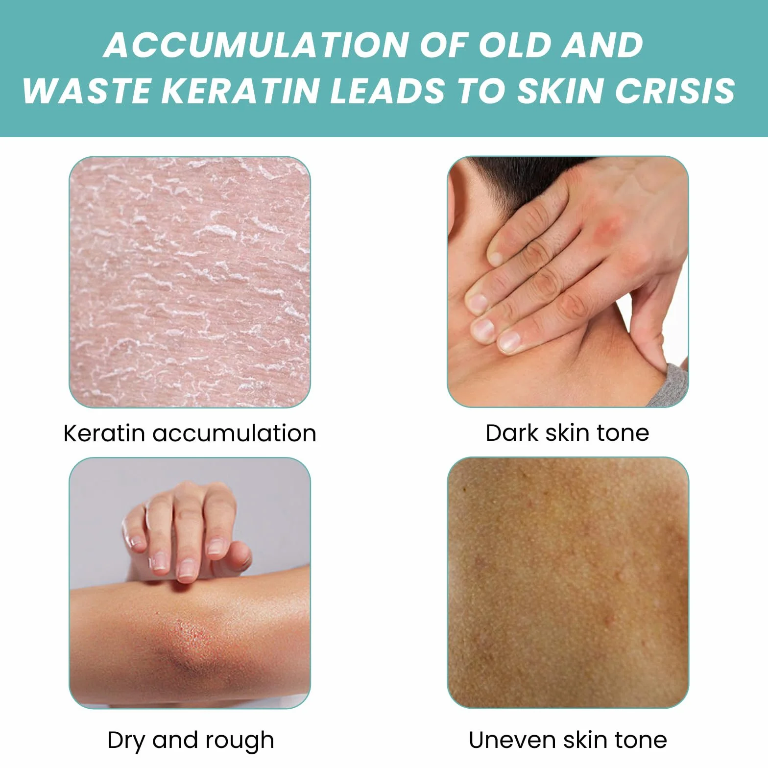 Acidified Original Skin Bath Oil So Soft Original Skin Bath Oil So Soft, oryginalny olejek do kąpieli, miękki, miękki, oryginalny olejek do kąpieli, wygładza i zmiękcza suchą lub szorstką skórę