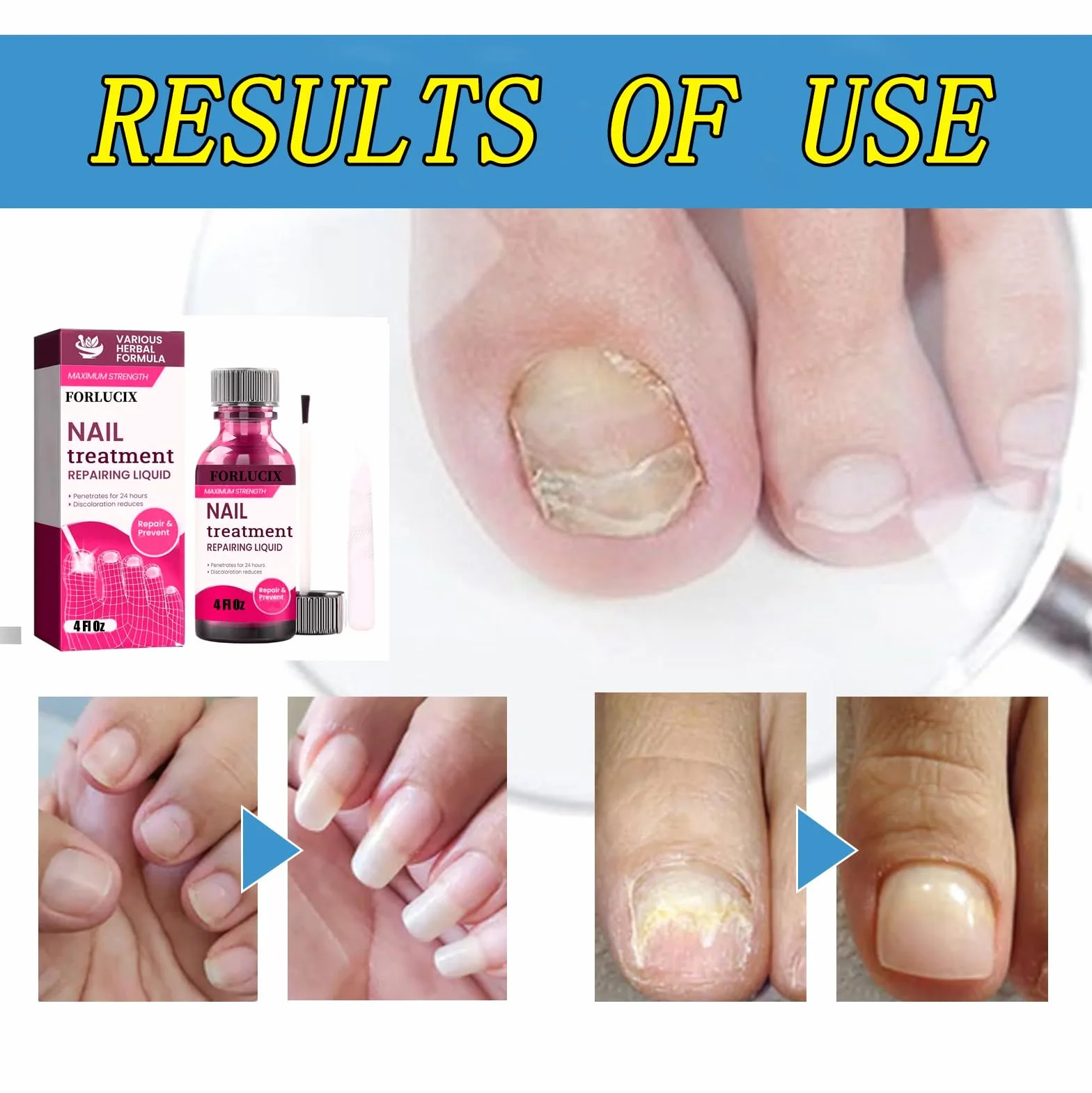 Extra Strength,4 Fl Oz(Pack of 1),Pink