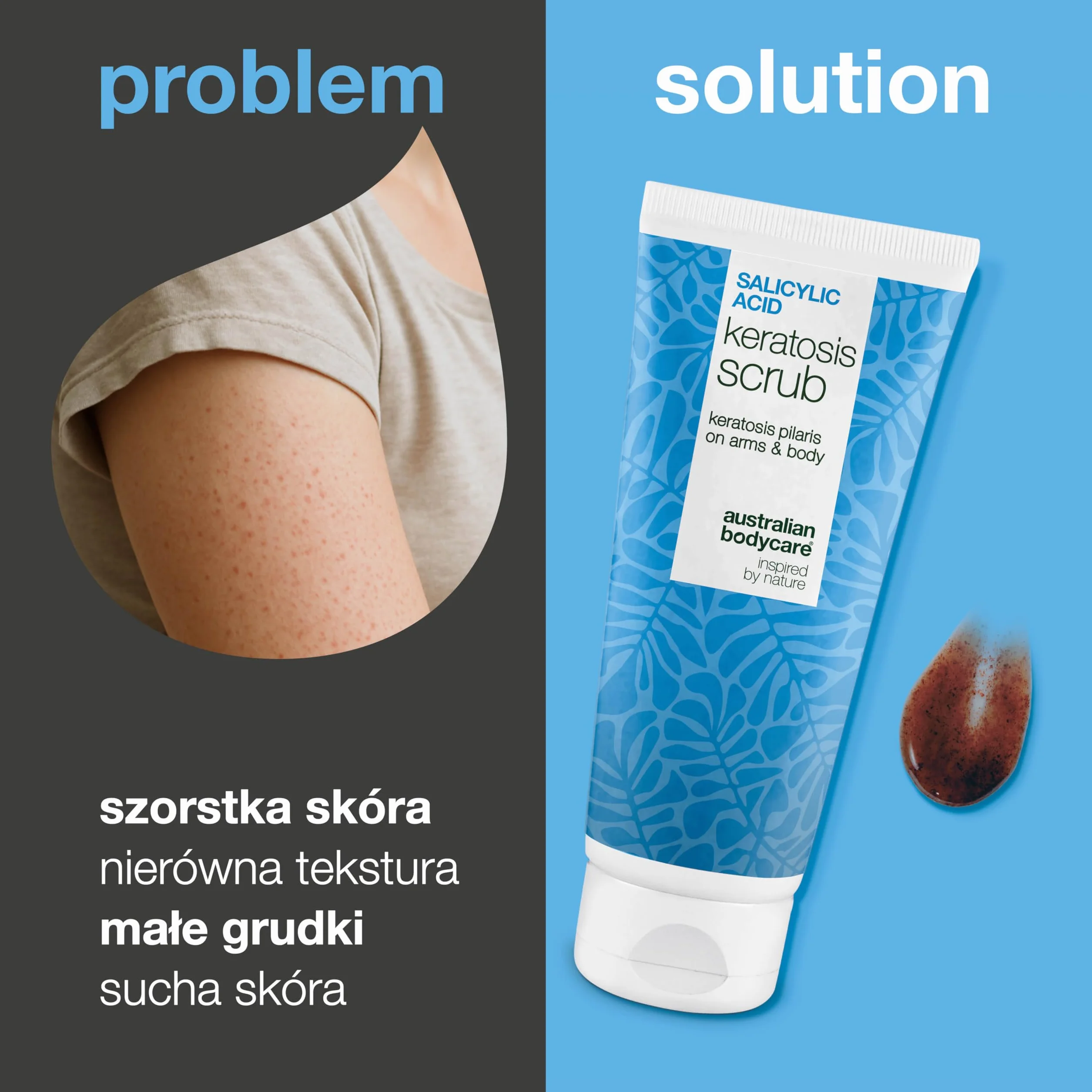 Peeling chemiczny AHA/BHA do ciała na rogowacenie mieszkowe, truskawkowe nogi i wrastające włoski z kwasem salicylowym, glikolowym i pestkami moreli