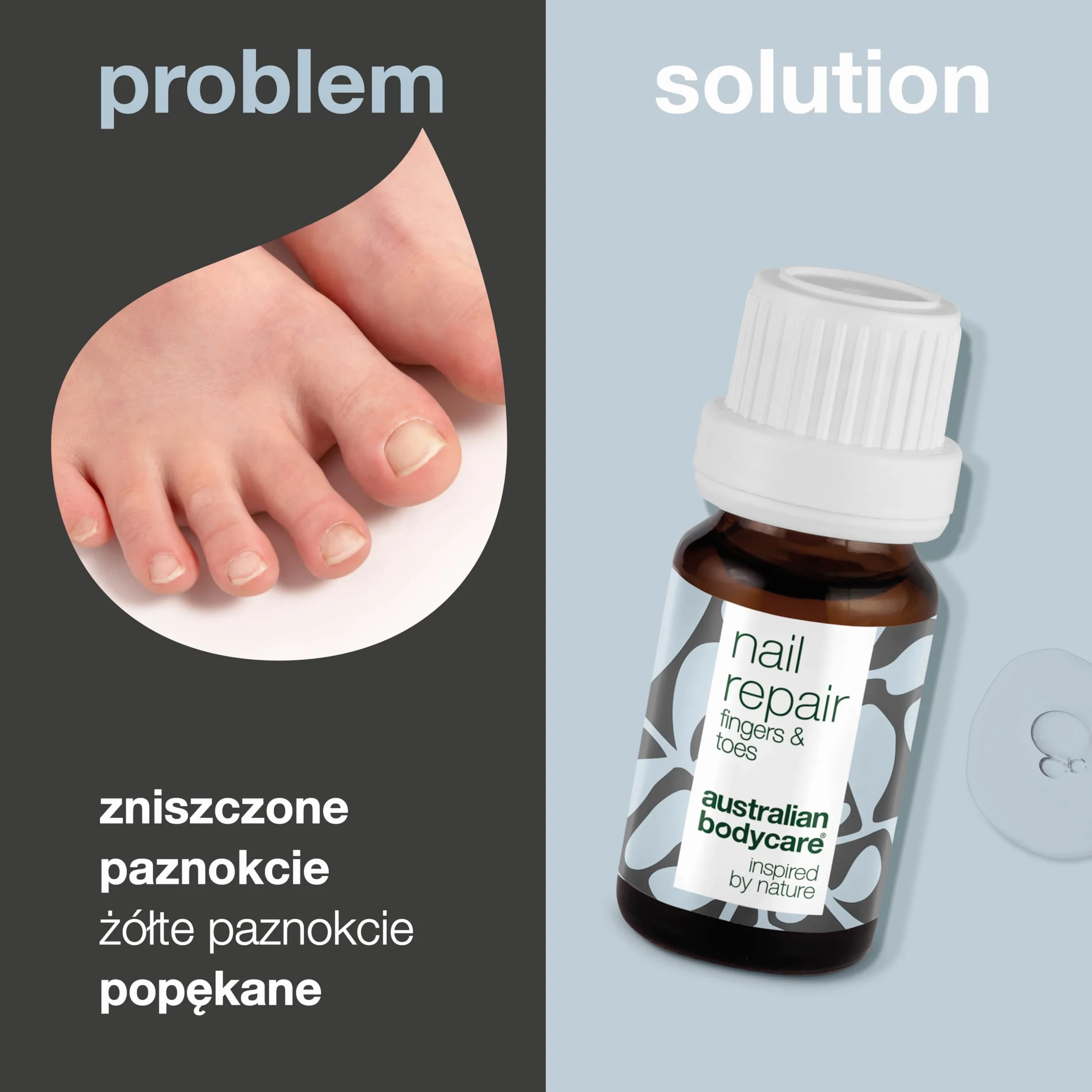 Australian Bodycare Nail Repair, 10ml | Pielęgnacja paznokci przebarwionych | Pomaga w oczysczaniu paznokcia i pielęgnacji grzybicy | z 100% naturalnym Olejkiem z Drzewa Herbacianego i witaminą E
