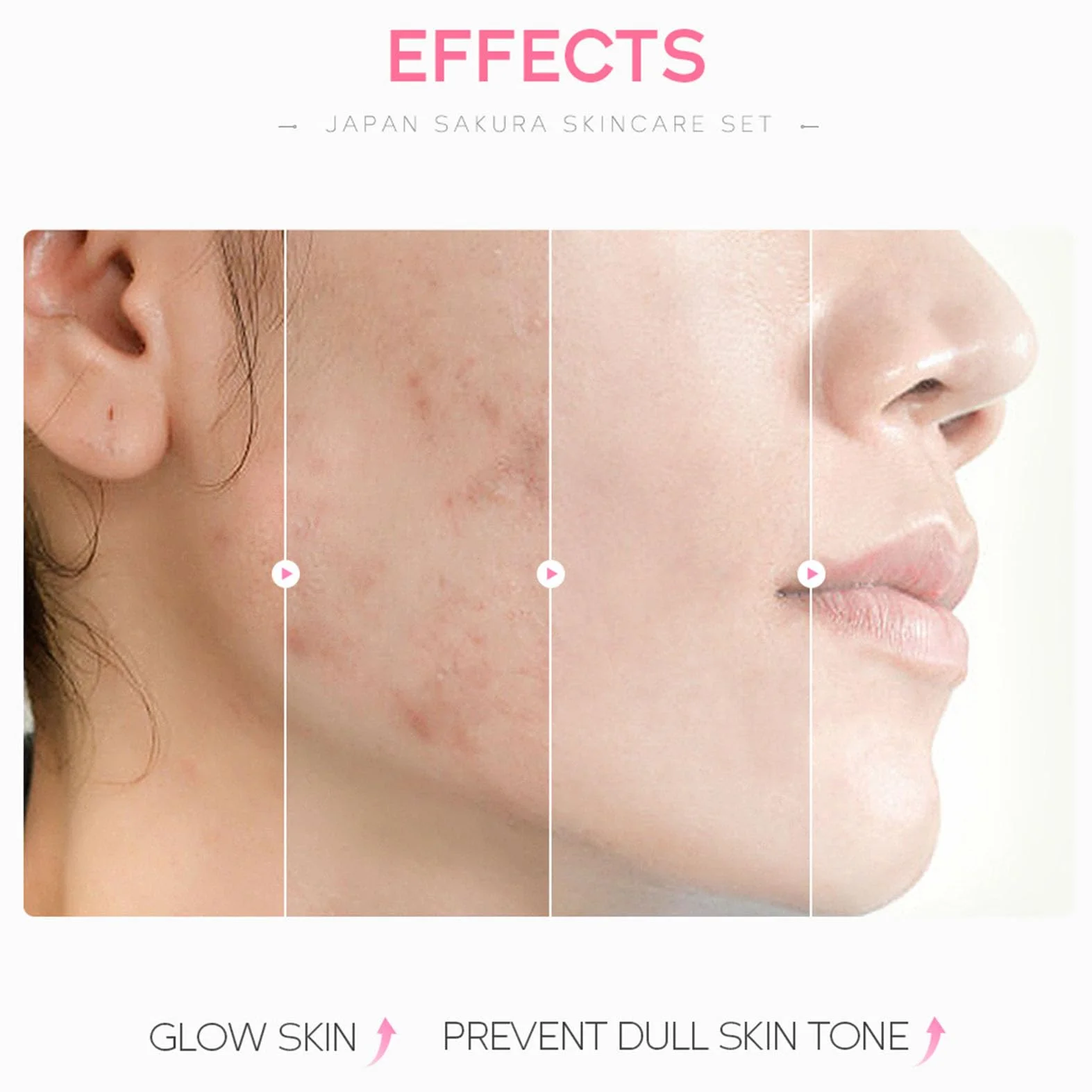 Japan Sakura zestaw do pielęgnacji skóry dla nastolatek i dziewcząt – Sakura Skin Care, zestaw do pielęgnacji twarzy, nawilżający zestaw upominkowy dla kobiet – z maską błotną, serum, kremem, kremem